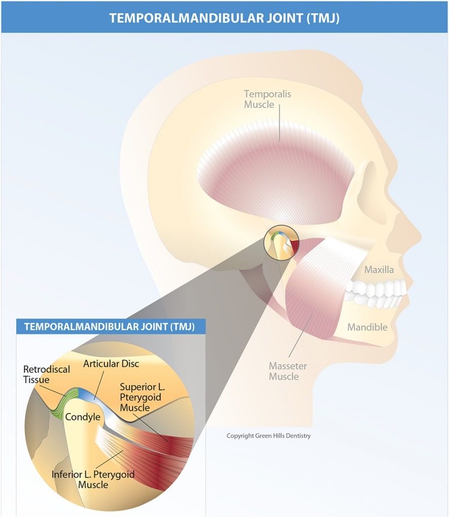 Temporalmandibular graphic