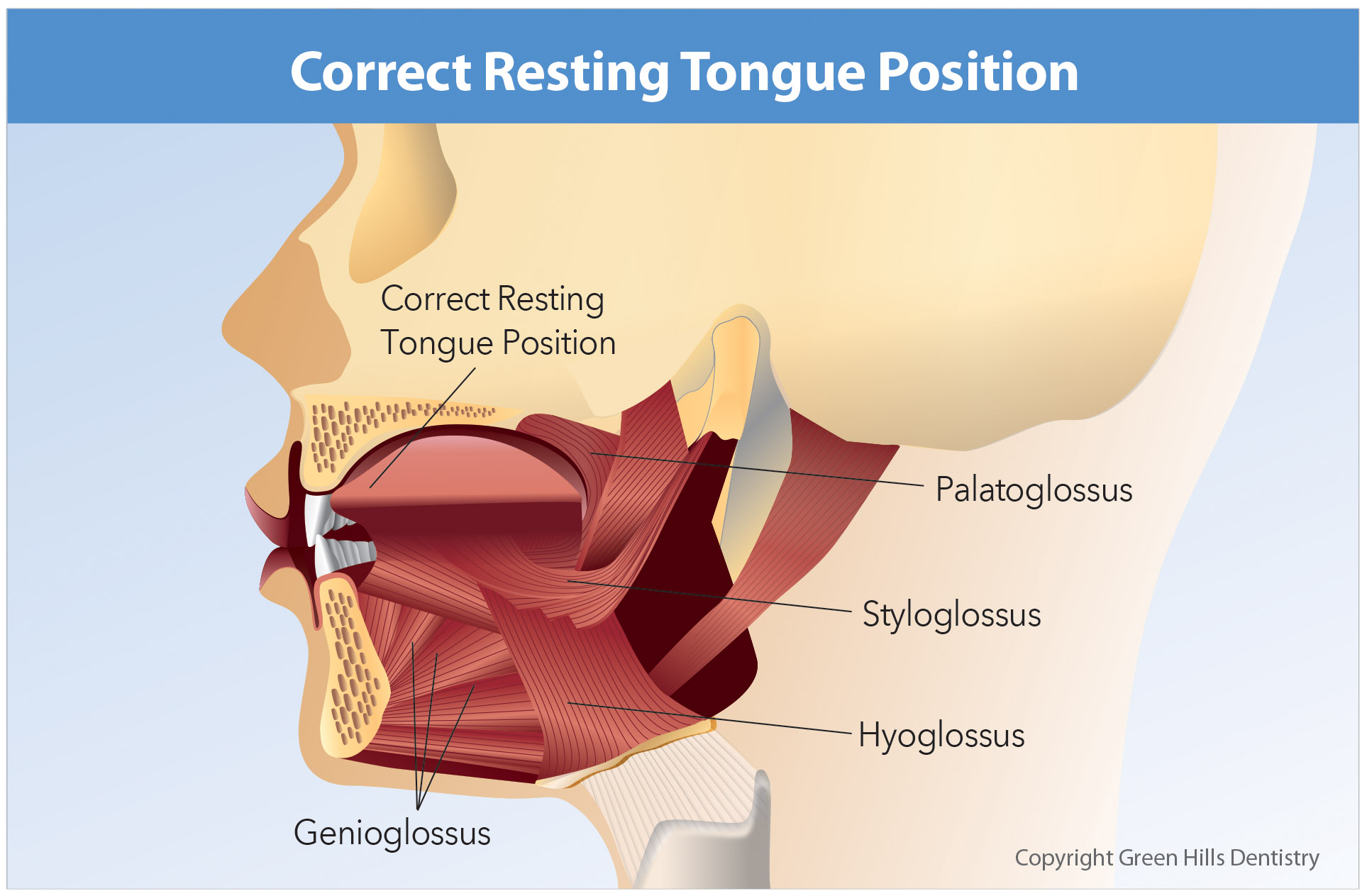 Correct resting tongue position
