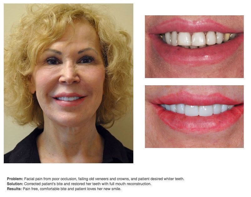 Cosmetic Dentistry in Allentown, PA