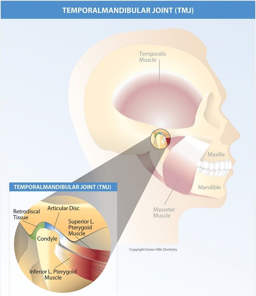 TMJ Treatment in Allentown, PA